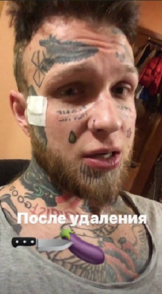 Татуированный сын Елены Яковлевой удалил пенис
