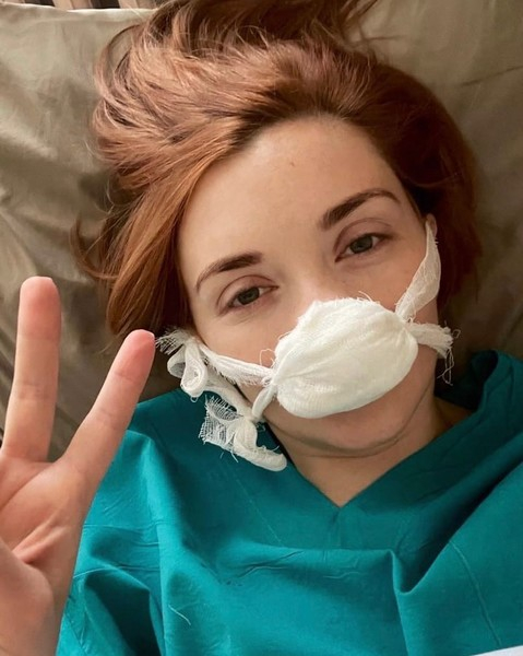 Ольга Кузьмина перенесла операцию из-за проблем с носом