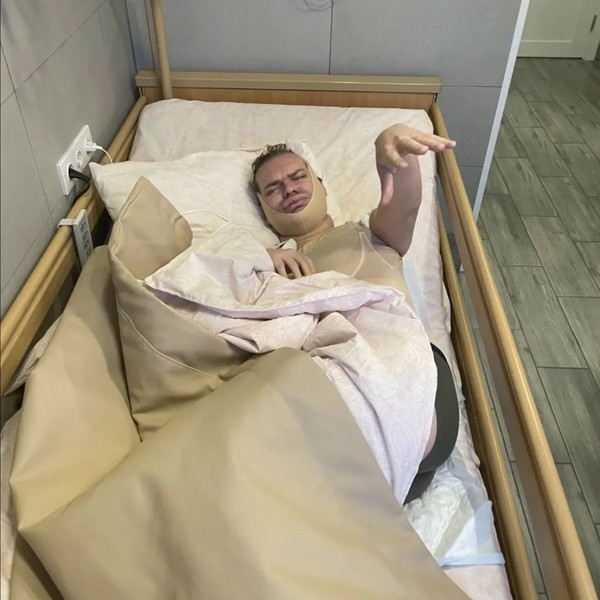 Неузнаваем после семичасовой операции: Гоген Солнцев рассказал, что сделал с телом
