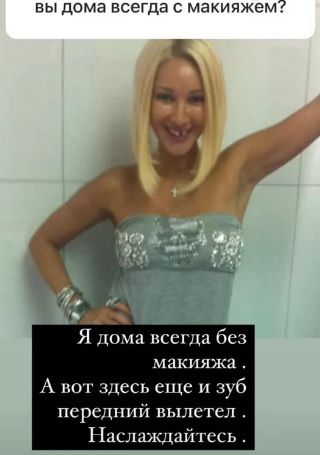 Лера Кудрявцева показала себя без макияжа и с выбитым зубом
